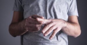 What Helps Reduce Rheumatoid Arthritis