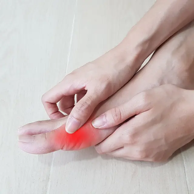 Gout