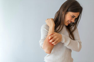 Why You Have Psoriasis